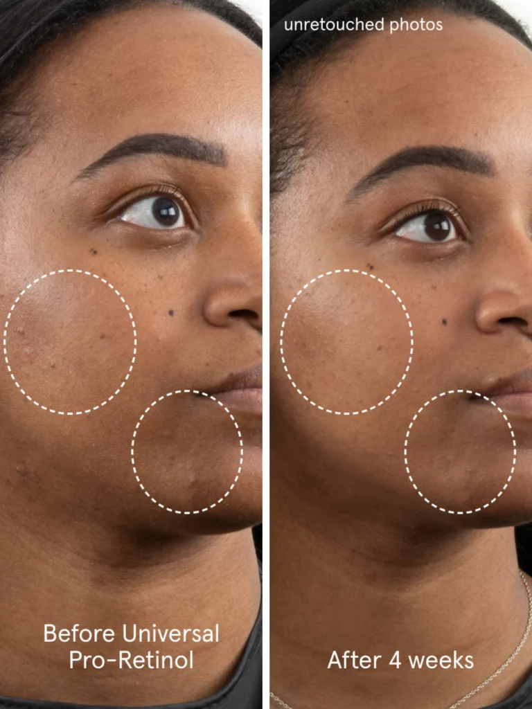 glossier-universal-pro-retinol-results