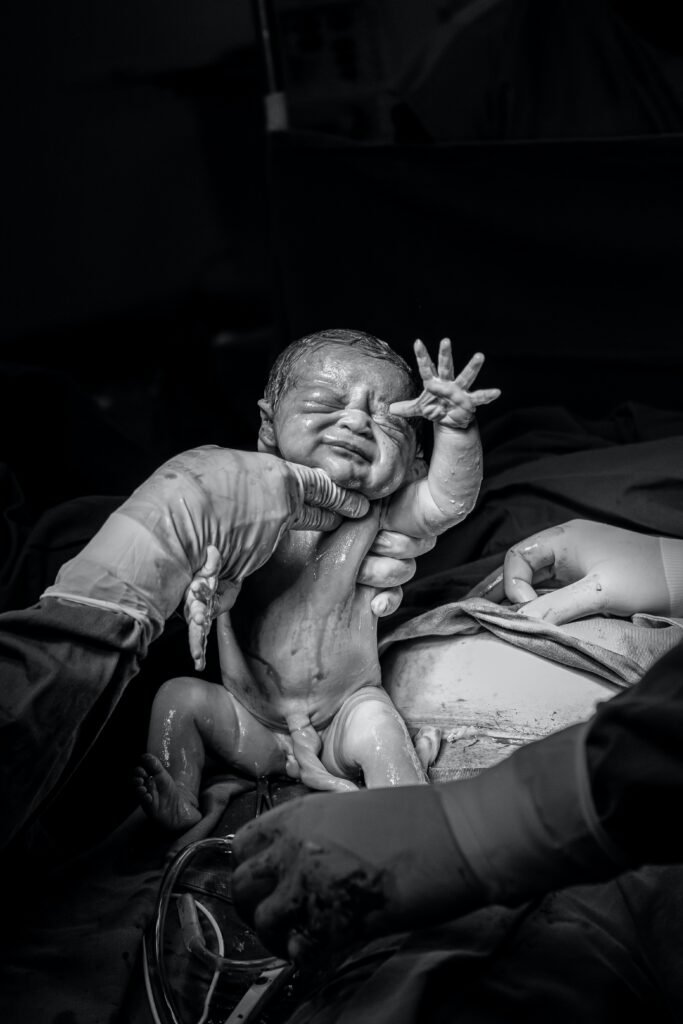 baby-born-tokophobia-fear-of-child-birth